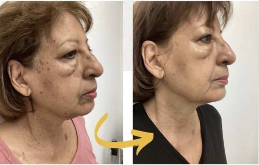 After treatment - Client 3